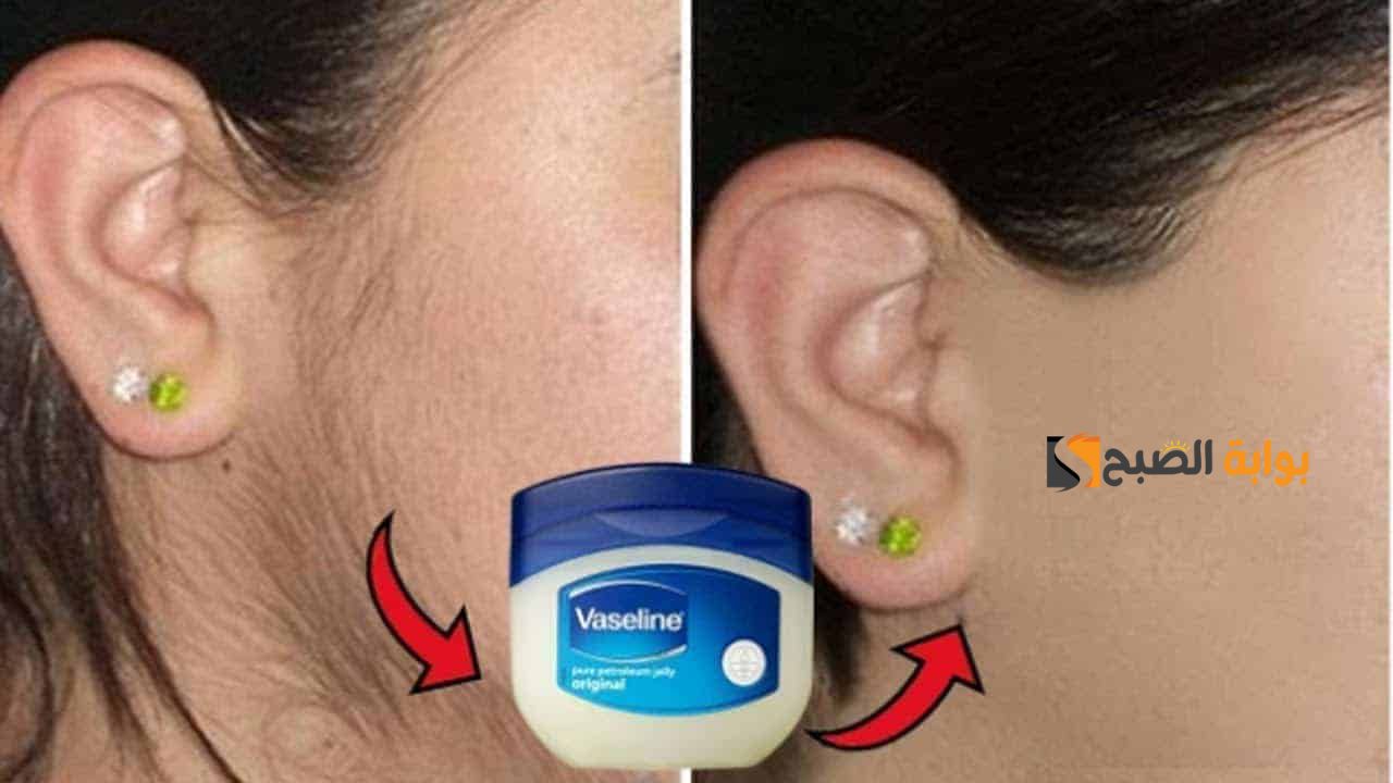 وصفة طبيعية ترجع العجوزة صبية .. أسهل طريقة لإزالة الشعر في المنزل بالخل والملح " حاجة كدة وهم 3 في 1 إزالة وتفتيح وتبييض " 5 وصفة طبيعية ترجع العجوزة صبية .. أسهل طريقة لإزالة الشعر في المنزل بالخل والملح ” حاجة كدة وهم 3 في 1 إزالة وتفتيح وتبييض “