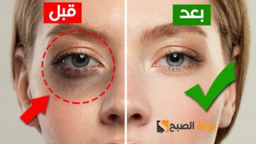 فايتك كتير لو متعرفيهاش .. وصفة الزبادي مع جل الصبار والعسل لإزالة الهالات السوداء حول العين ويقع البشرة ” هتخلي عيونك شعاع من نور”