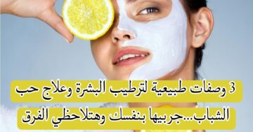 3 وصفات طبيعية لترطيب البشرة وعلاج حب الشباب… جربيها بنفسك وهتلاحظي الفرق