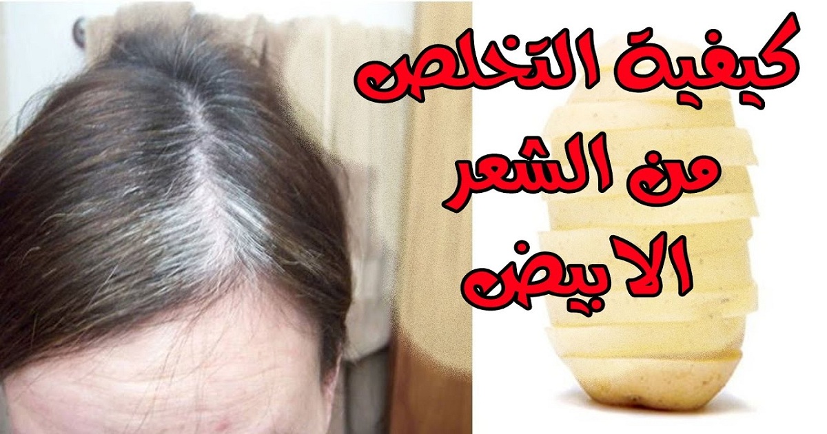 وصفة سحرية بالخميرة للتخلص من الشعر الأبيض نهائيا والنتيجة من أول استخدام 5 وصفة سحرية بالخميرة للتخلص من الشعر الأبيض نهائيا والنتيجة من أول استخدام