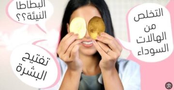 “مجربة وفعالة”وصفات طبيعية للتخلص من الهالات السوداء تحت العين تدريجيا