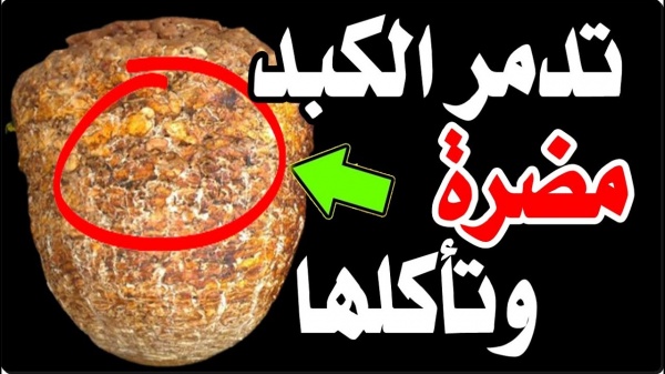 أطعمه ضارة يجب تجنبها للحفاظ علي صحة الجسم والوقاية من الأمراض 5 أطعمه ضارة يجب تجنبها للحفاظ علي صحة الجسم والوقاية من الأمراض