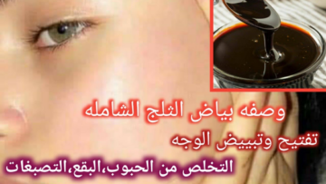 بملعقة واحدة من العسل الأسود..بشرتك هتنور من تاني في أقل من 15 دقيقة