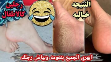 نص جمالك في كعب رجلك.. احصلي على قدمين خالية من التشققات والسواد بالطريقة دي