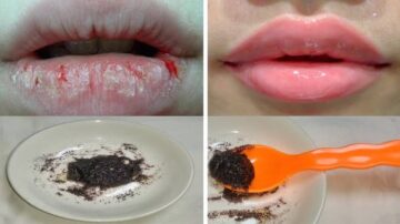 حطي الفازلين على العسل وهتنبهري من النتيجة.. 3 خلطات سحرية آمنه تساعد على تقشير الشفايف