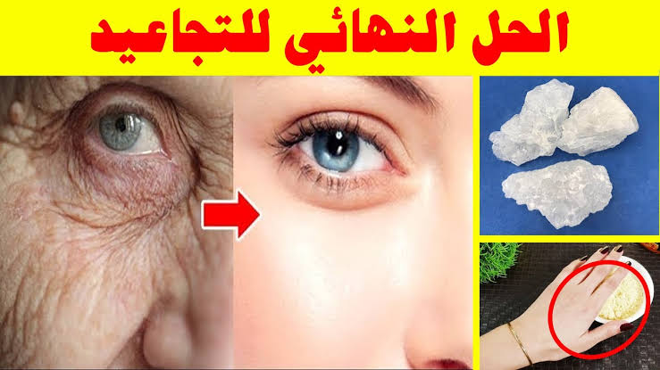 عودي لشبابك.. أقوى الوصفات رائعة للتخلص من التجاعيد وعلامات التقدم في العمر في دقائق معدودة! 6 عودي لشبابك.. أقوى الوصفات رائعة للتخلص من التجاعيد وعلامات التقدم في العمر في دقائق معدودة!