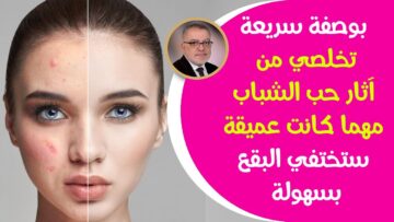 تفتيح البشرة وإزالة الحبوب بكل سهولة بوصفات طبيعية وآمنة