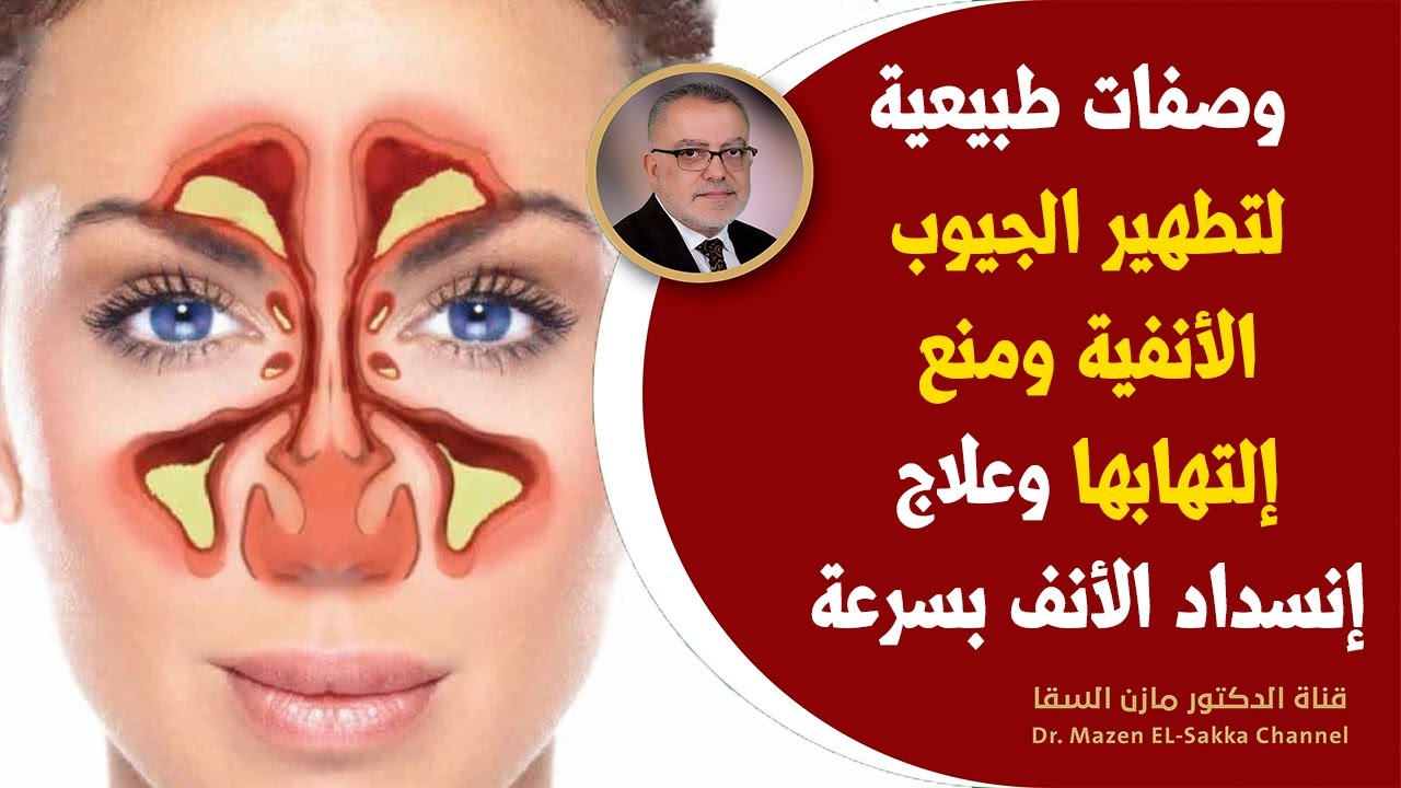 طريقة تنظيف الجيوب الأنفية والجهاز التنفسي بطريقة سهلة وبسيطة من غير طبيب 5 طريقة تنظيف الجيوب الأنفية والجهاز التنفسي بطريقة سهلة وبسيطة من غير طبيب