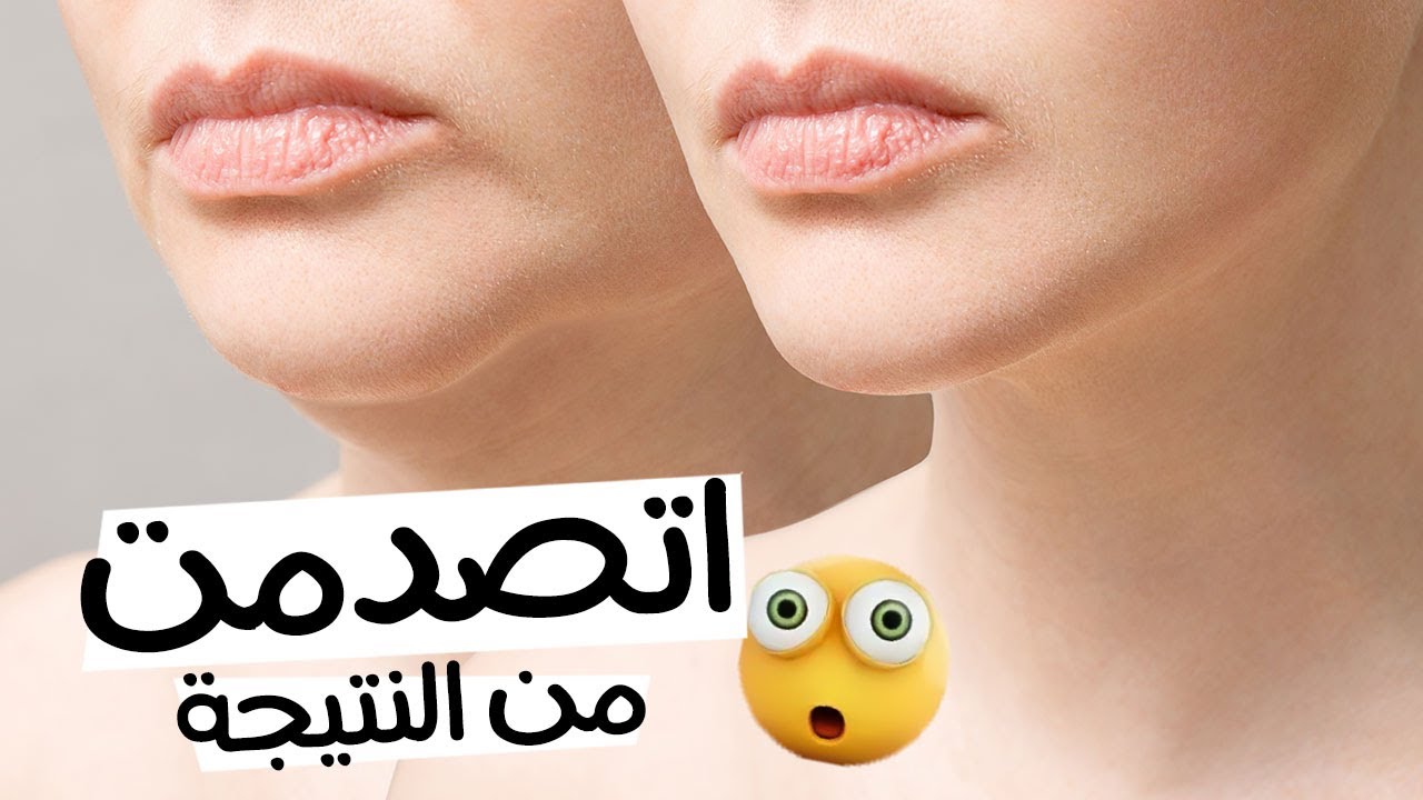 سيروم لشد الوجه من صنع ايديك اوعى تاني تشتريه نتيجته من أول أسبوع 5 سيروم لشد الوجه من صنع ايديك اوعى تاني تشتريه نتيجته من أول أسبوع