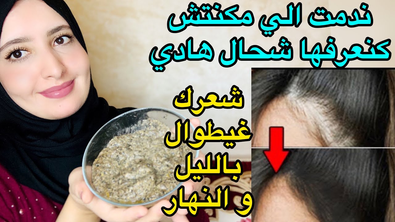 وصفة علاج تساقط السعر ضعيها على شعرك وتملأ الفراغات من أول استعمال 5 وصفة علاج تساقط السعر ضعيها على شعرك وتملأ الفراغات من أول استعمال