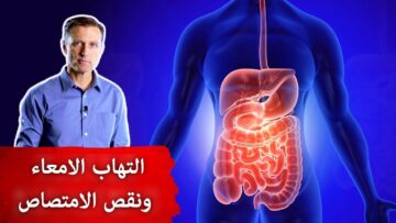 أفضل من الدواء.. ” مشروب بسيط يعالج قرحة المعدة والتقلصات رخيص الثمن