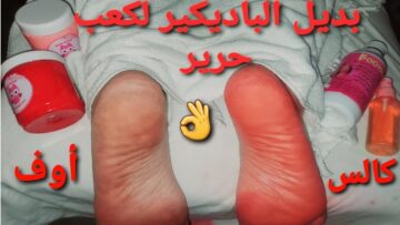 كملي الحتة اللي نقصاكي.. مقشر منزلي للكعبين للتخلص من السواد والتشققات