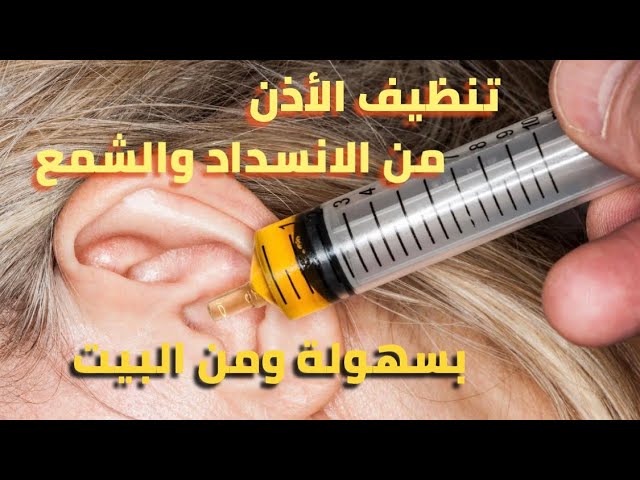 طريقة سحرية لتنظيف الأذن من الشمع في المنزل ببساطه وبأمان وبدون ألم 5 طريقة سحرية لتنظيف الأذن من الشمع في المنزل ببساطه وبأمان وبدون ألم