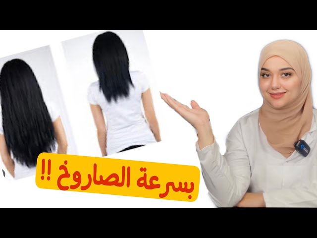 كريم ساحر لتطويل الشعر وانبات الفراغات وعلاج التساقط نهائيا من اول يوم 5 كريم ساحر لتطويل الشعر وانبات الفراغات وعلاج التساقط نهائيا من اول يوم