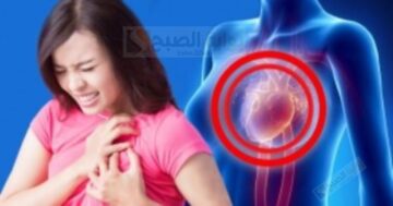 أسباب السكتة القلبية لدى النساء.. توخي الحذر منها