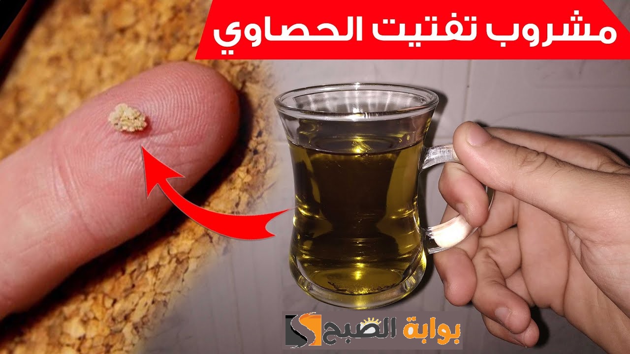 أفضل مشروب يساعد في تفتيت حصى الكلى ويقلل آلامها 5 أفضل مشروب يساعد في تفتيت حصى الكلى ويقلل آلامها