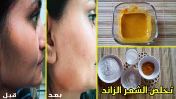 مش هتحتاجي الليزر تاني… وصفة النشا والكركم للتخلص من الشعر الزايد في غمضة عين