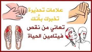 علامات لو ظهرت على جسمك فإنها تشير إلى نقص أهم فيتامين يجب عليك الانتباه