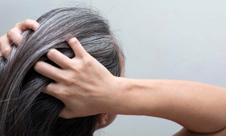 وداعاً لصبغات الشعر.. التخلص من الشعر الأبيض في يومين بمواد طبيعية 5 وداعاً لصبغات الشعر.. التخلص من الشعر الأبيض في يومين بمواد طبيعية