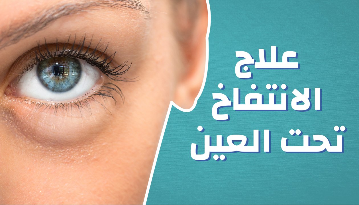 نصائح منزلية بسيطة للتخلص من انتفاخ أسفل العين.. وأبرز أسباب ظهور الانتفاخ