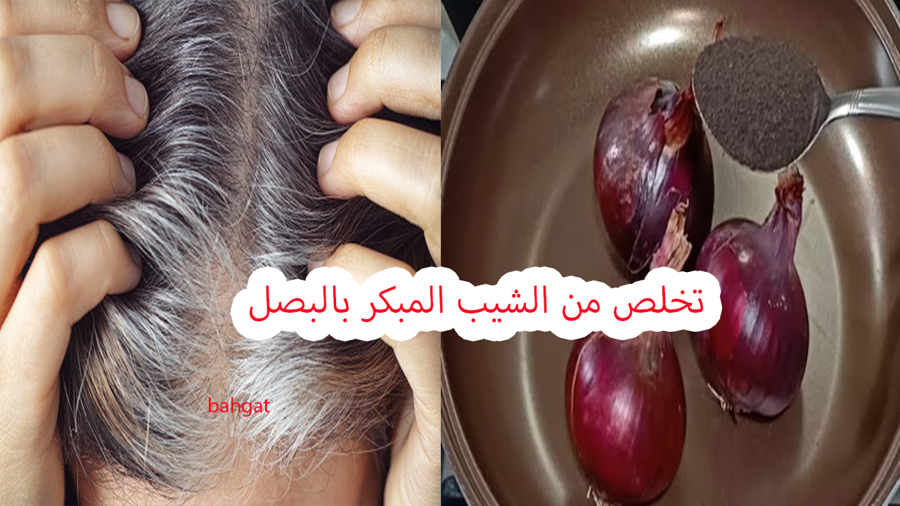 بالبصل تخلص من الشيب المبكر وتناول أطعمة تعيد لك شعرك الأسود في أسرع وقت