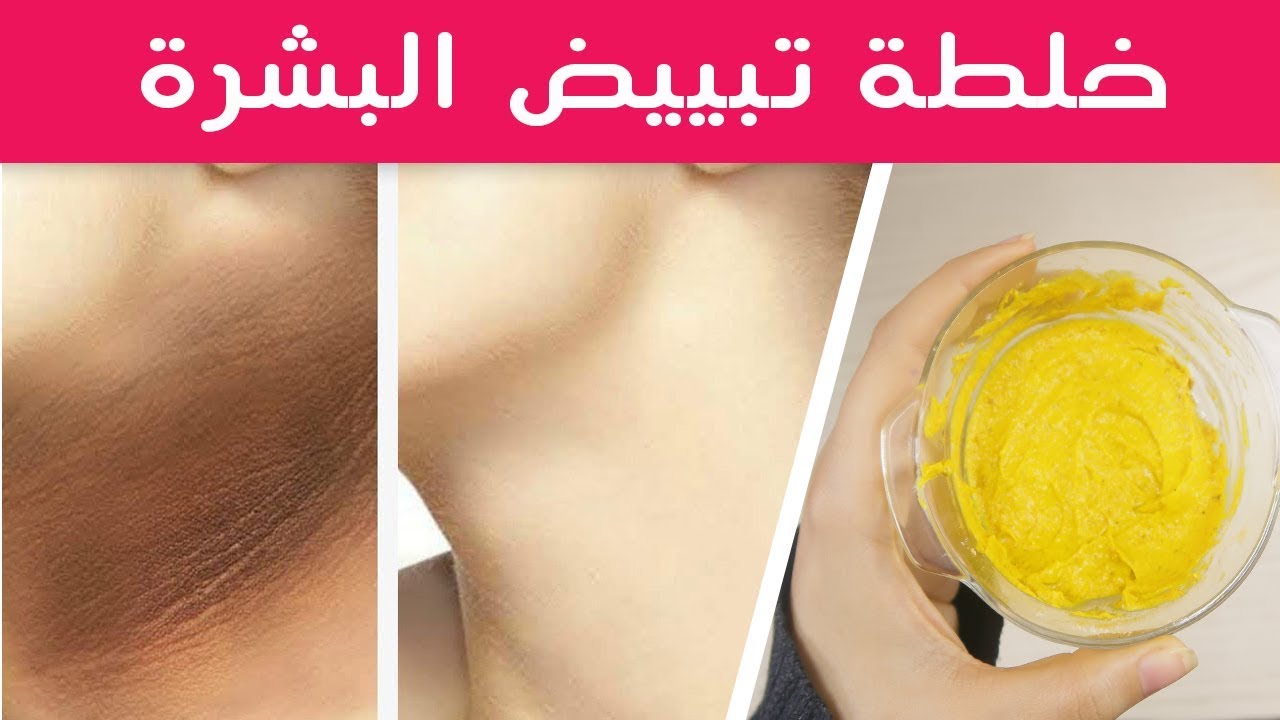 بدهنة من هذه الخلطة رقبتك هتبقي بيضة قشطة بدون سواد أو تصبغات