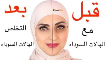 عيونك هتنور.. وصفة البقدونس والزبادي الحل المثالي للتخلص من الهالات السوداء حول العين في أقل من ٢٠ دقيقة