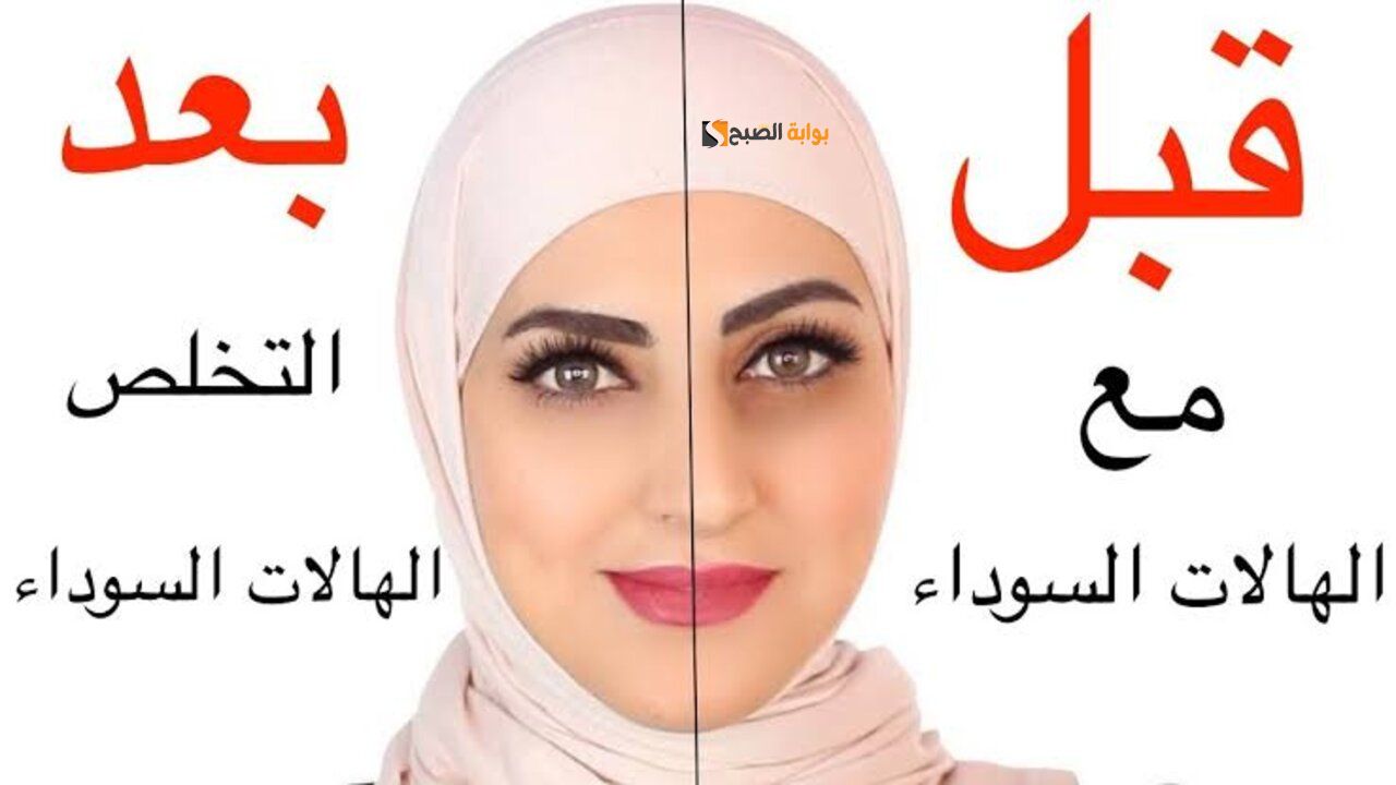 عيونك هتنور.. وصفة البقدونس والزبادي الحل المثالي للتخلص من الهالات السوداء حول العين في أقل من ٢٠ دقيقة 5 عيونك هتنور.. وصفة البقدونس والزبادي الحل المثالي للتخلص من الهالات السوداء حول العين في أقل من ٢٠ دقيقة
