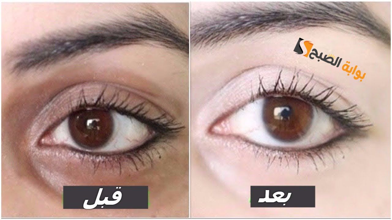 قولي وداعا الهالات.. وصفة ممتازة من العرقسوس لإزالة الهالات السوداء والاسمرار حول العين 5 قولي وداعا الهالات.. وصفة ممتازة من العرقسوس لإزالة الهالات السوداء والاسمرار حول العين