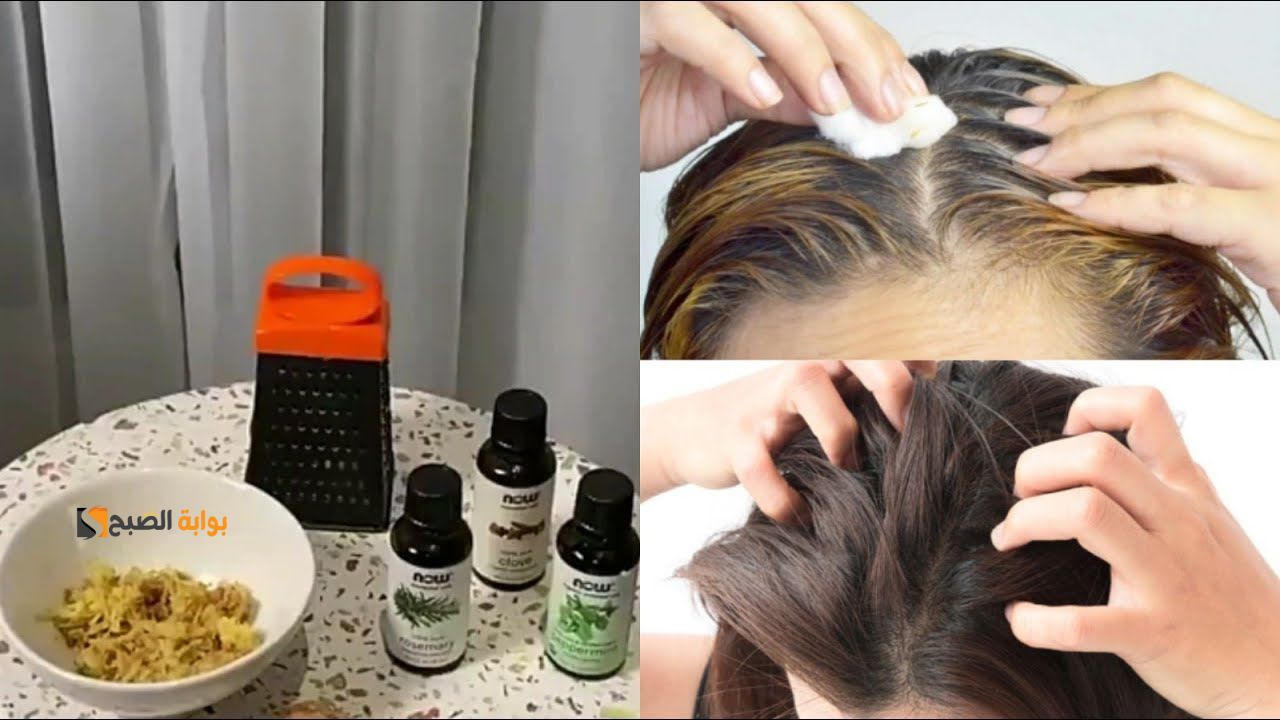 حتى لو حالته تدهورت.. قناع القرنفل وإكليل الجبل لمنع تساقط الشعر وزيادة كثافته "مش هيتربط من تقله" 5 حتى لو حالته تدهورت.. قناع القرنفل وإكليل الجبل لمنع تساقط الشعر وزيادة كثافته “مش هيتربط من تقله”