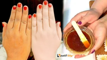 وصفات طبيعيه لتفتيح اليدين وإزالة الاسمرار عنها “هتبقى ناعمة ومنورة”