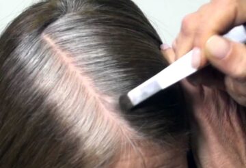وصفات طبيعية للتخلص من الشعر الأبيض نهائيًا بمكونات متوفرة