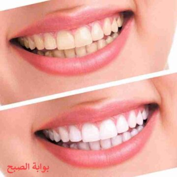طريقة صنع بودرة تبيض الاسنان وغسول الفم في المنزل