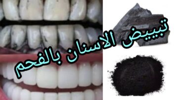 قطعة فحمة صغيرة سر تنظيف الأسنان بديل لجلسات التنظيف المكلفة وهتشوفي أسنانك بيضاء إزاي