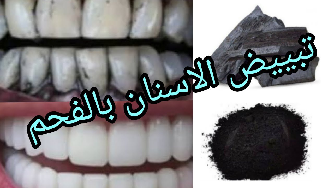 قطعة فحمة صغيرة سر تنظيف الأسنان بديل لجلسات التنظيف المكلفة وهتشوفي أسنانك بيضاء إزاي 5 قطعة فحمة صغيرة سر تنظيف الأسنان بديل لجلسات التنظيف المكلفة وهتشوفي أسنانك بيضاء إزاي