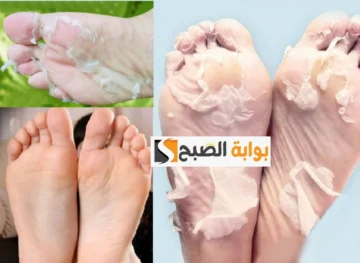 أقوى وصفة طبيعية لتنعيم اليدين والقدمين مع التفتيح السريع بخطوات بسيطة من صنع إيدك