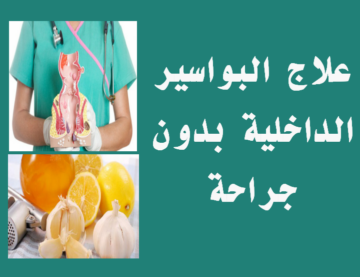 بطرق طبيعية علاج البواسير الداخلية والخارجية طرق إزالة البواسير بدون عملية جراحية