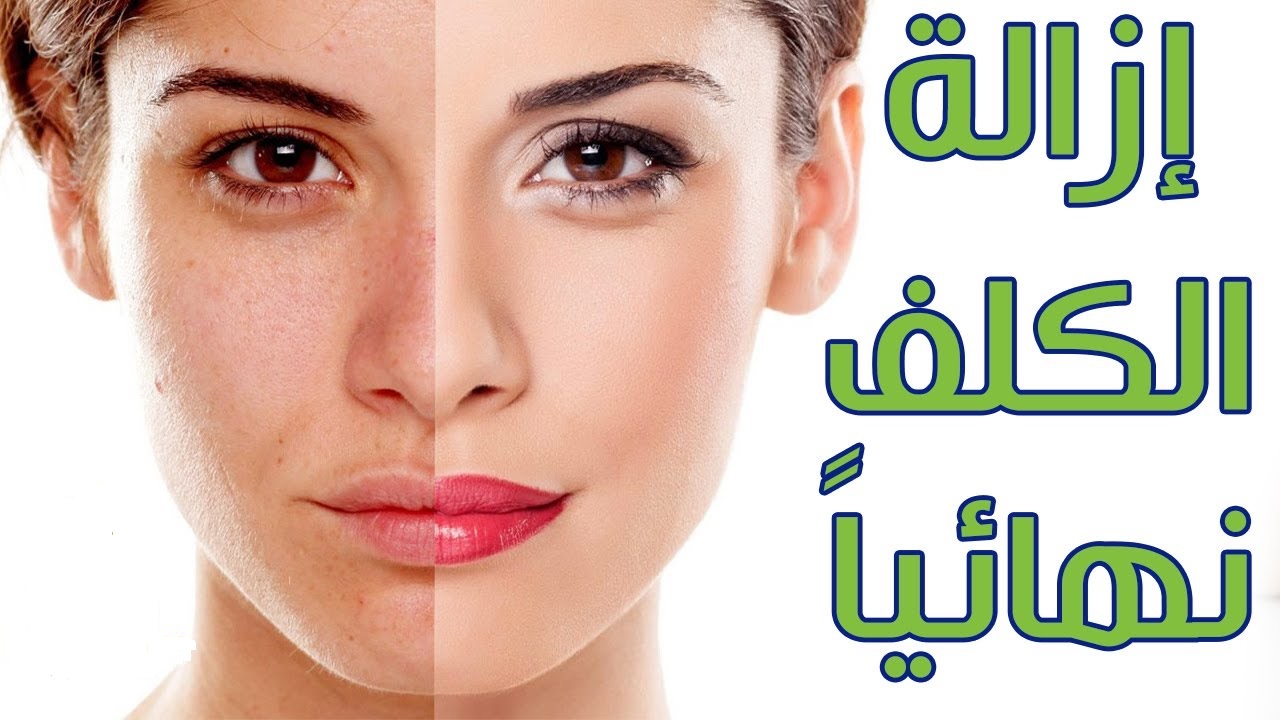 الخلطة السحرية لتبييض الوجه وعلاج الكلف والنمش بشكل طبيعي ونهائياً لبشرة صافية وجميلة 5 الخلطة السحرية لتبييض الوجه وعلاج الكلف والنمش بشكل طبيعي ونهائياً لبشرة صافية وجميلة