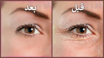 جربي إزاي تتخلصي من تجاعيد وانتفاخات حول العين بمكونات منزلية وغير مكلفة