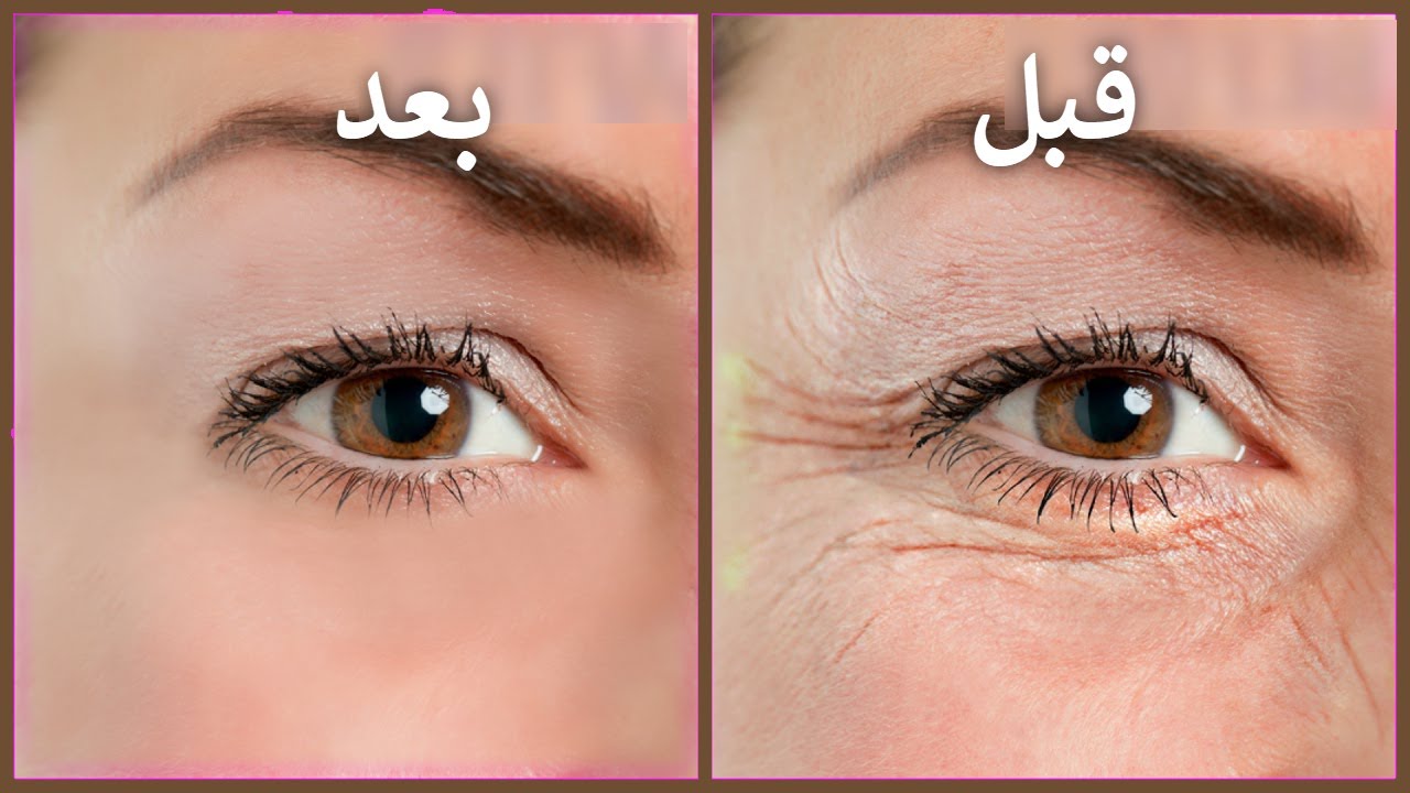 جربي إزاي تتخلصي من تجاعيد وانتفاخات حول العين بمكونات منزلية وغير مكلفة