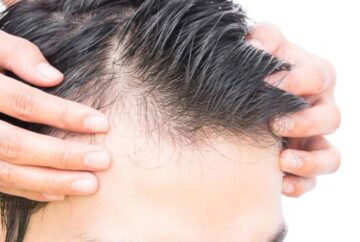وصفات وزيوت طبيعية هتساعدك على علاج فراغات الشعر وزيادة كثافته وطوله