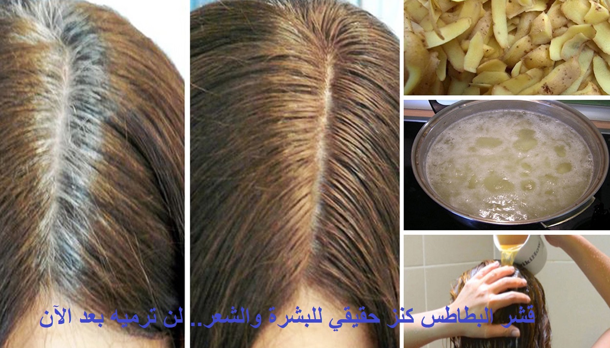 قشر البطاطس كنز حقيقي لنضارة البشرة وتكثيف وتنعيم الشعر.. لن ترميه بعد الآن!