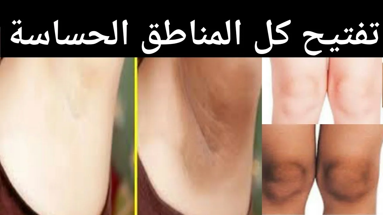 خلطات لتفتيح المناطق الحساسة بدون أي مواد كيمياوية والنتيجة مذهلة 5 خلطات لتفتيح المناطق الحساسة بدون أي مواد كيمياوية والنتيجة مذهلة