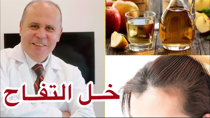 وصفات فرد وتنعيم الشعر بخل التفاح 5 وصفات فرد وتنعيم الشعر بخل التفاح