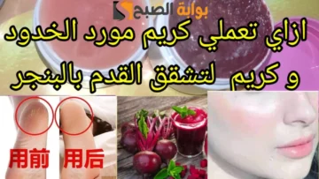 في فصل الشتاء وصفة طبيعية تخلصك من تشققات القدمين مع التنعيم “‘جمالك كعب رجلك”