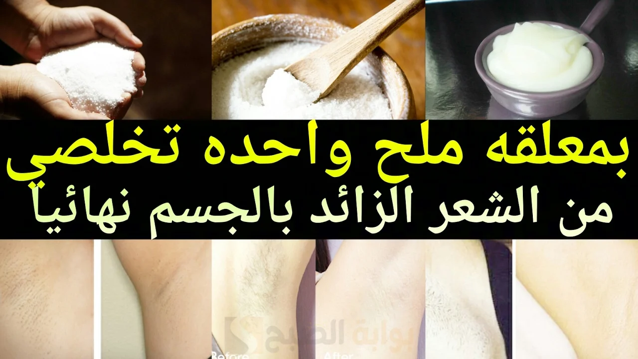 كل البنات جربتها .. وصفة الكركم والنشا لإزالة الشعر من الجسم كله في لحظات ” هتبقي فلة منورة زي الشمعة”