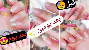 النتيجة من أول يومين.. وصفة تطويل الأظافر بمكونات طبيعية ومنحها مظهر جمالي بدون كيماويات أو مواد ضارة