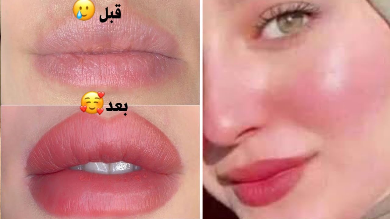 وشك هيبقي بدر منور وزي القشطة بخلطة توريد الخدود والشفايف في ربع ساعة هتسحري الكل من جمالك