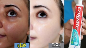 رشي النشا على معجون الأسنان وشوفي هيعملوا إيه لشبابك هيرجعوكي للعشرينات من تاني