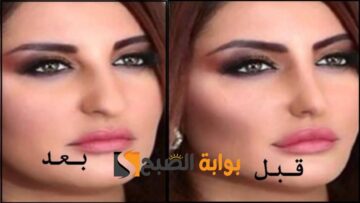 بمعلقة خميرة واحدة أفضل وصفة لتسمين الخدود وتوريدها ونفخ الوجه بدون فيلر وعمليات تجميل